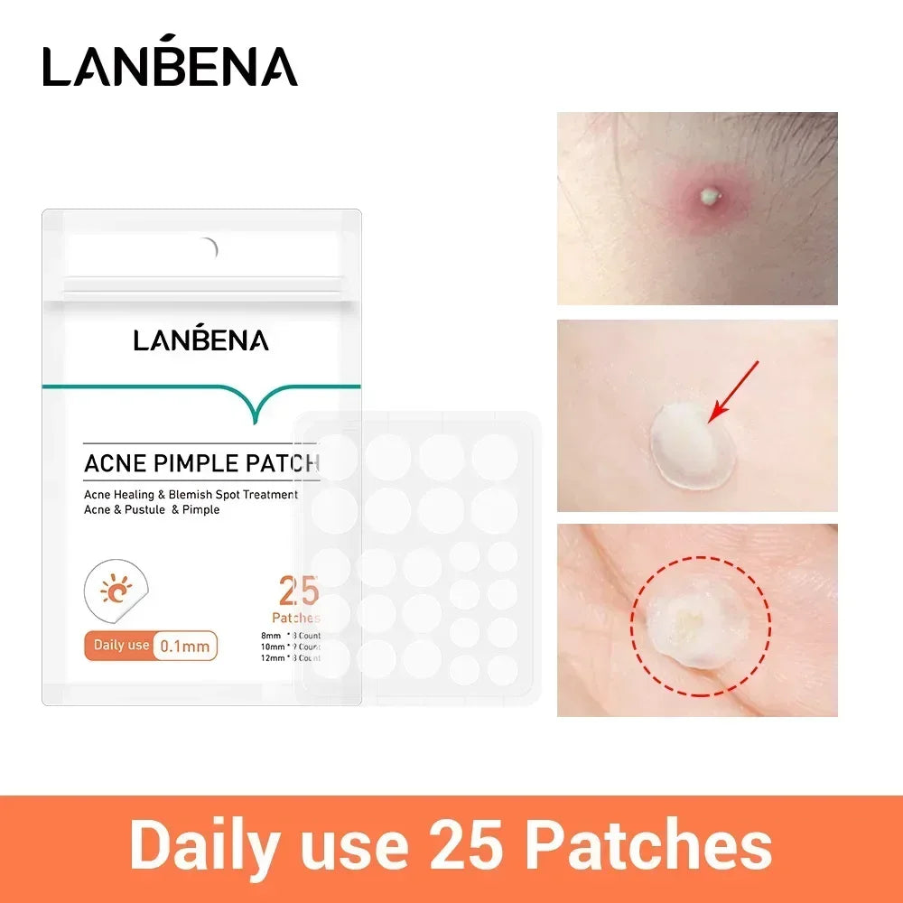Tea Tree Oil Acne Pimple Patches For Day And Night Use